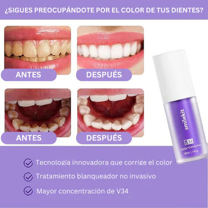 Blanqueador Dental V34™ - ¡PAGA 1 Y LLEVE 2 SOLO HOY! 